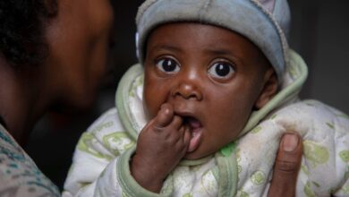 الأمم المتحدة: 100,000 طفل في اثيوبيا يواجهون الجوع المميت