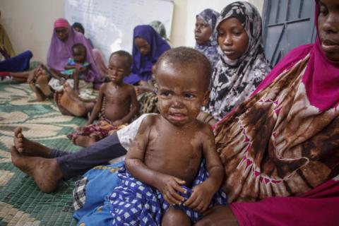 «يونيسف»: سوء التغذية يعرض 8 ملايين طفل لخطر الموت