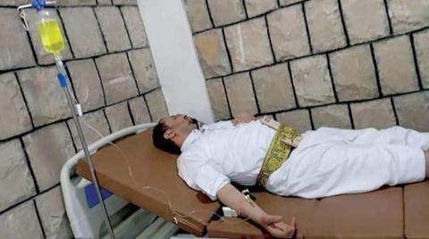 تدهور صحة الناجين من سجون الحوثيين